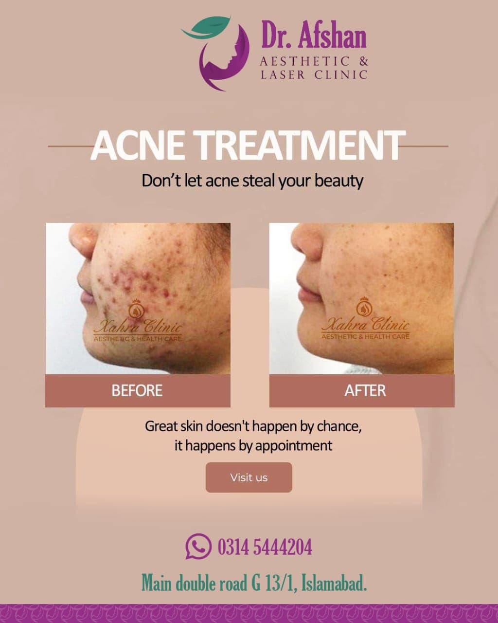 Acne & Scar Treatment — result 1