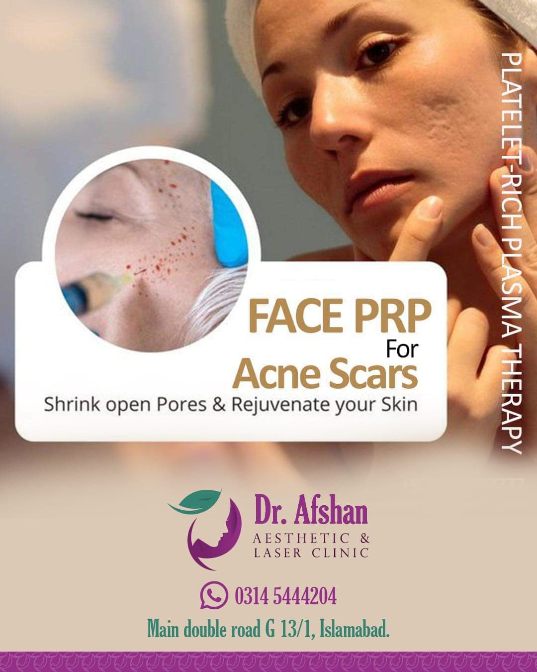 Acne & Scar Treatment — result 6