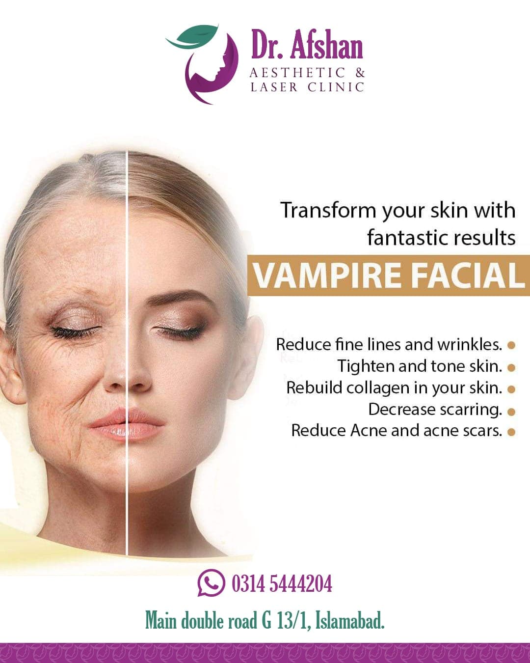 Acne & Scar Treatment — result 7