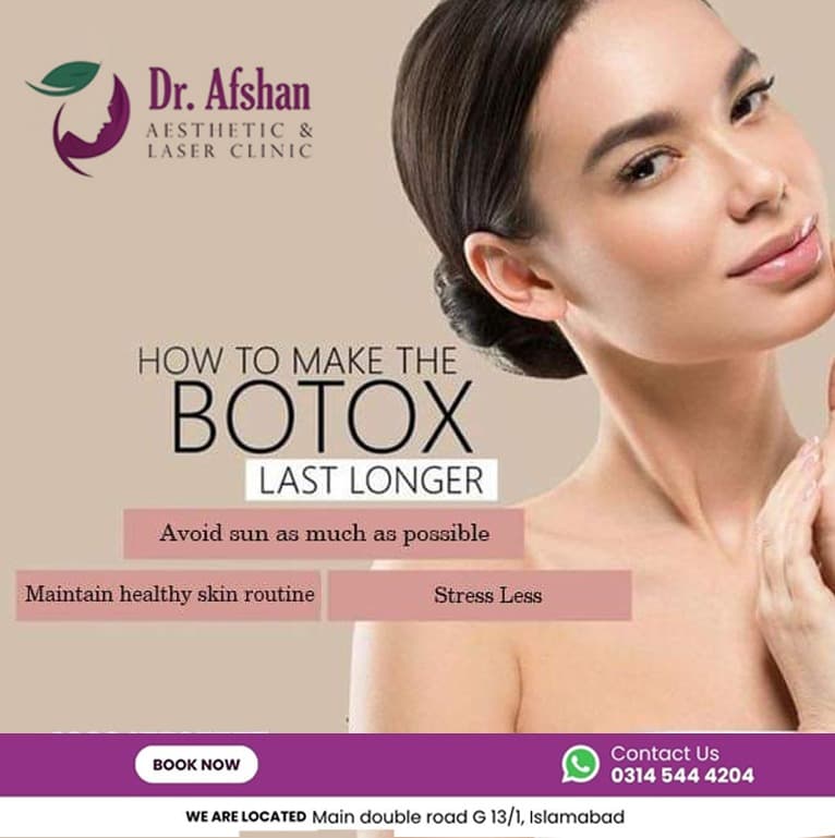 Botulinum Toxin (Botox) — result 4