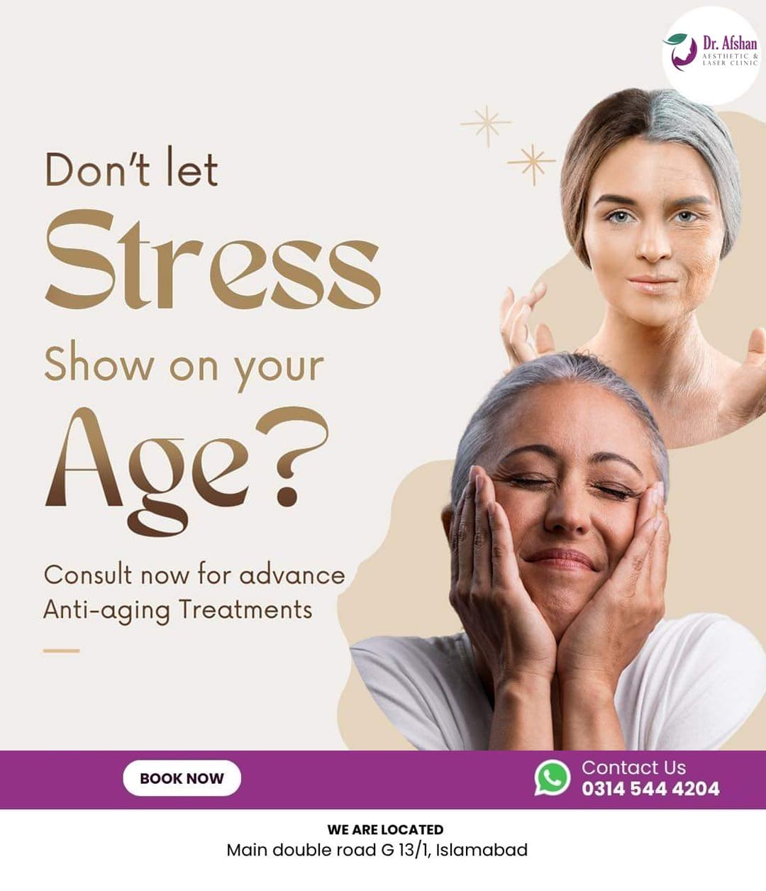 Botulinum Toxin (Botox) — result 5