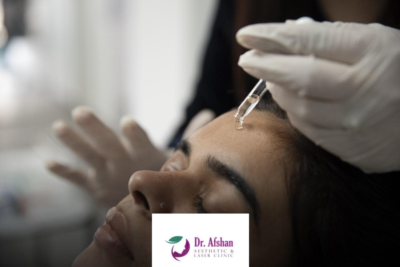 Botulinum Toxin (Botox) — result 6