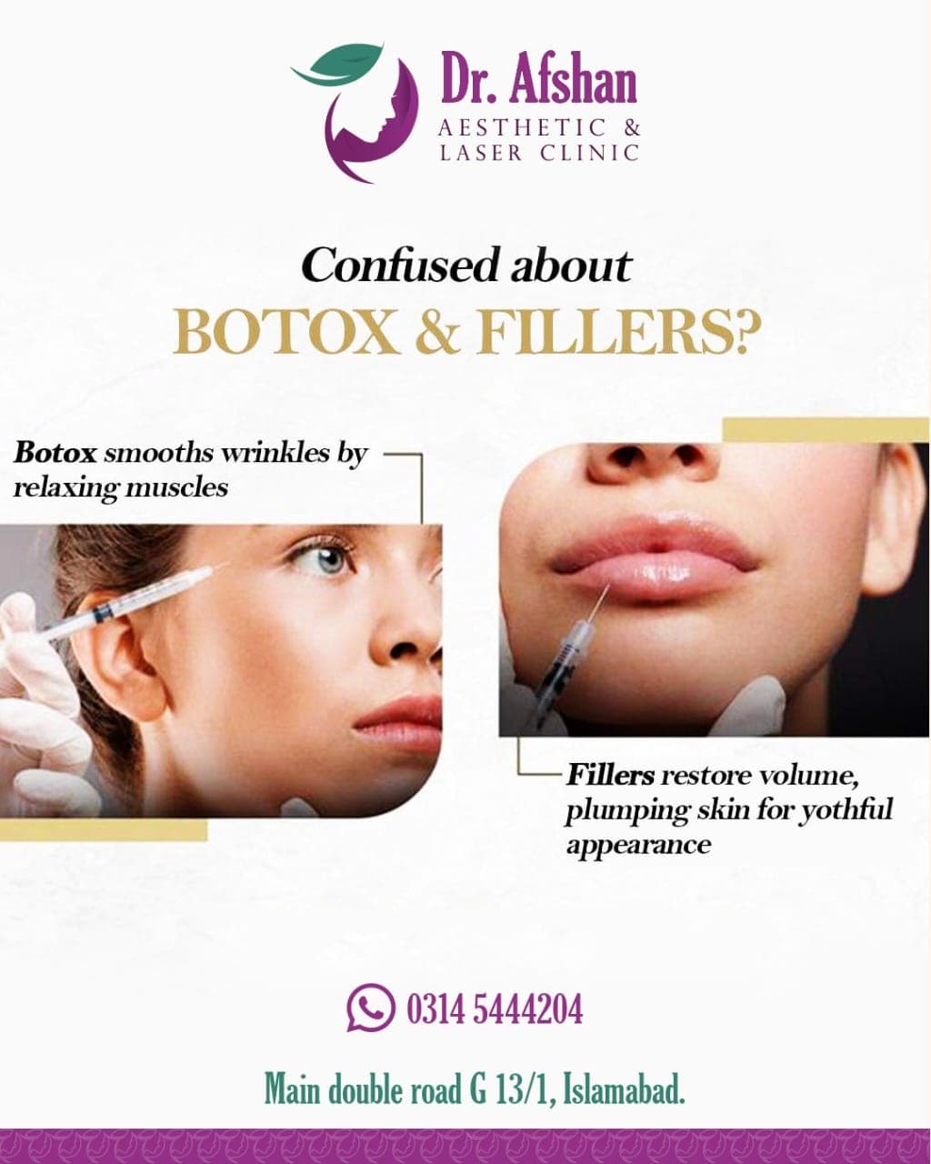 Botulinum Toxin (Botox) — result 7