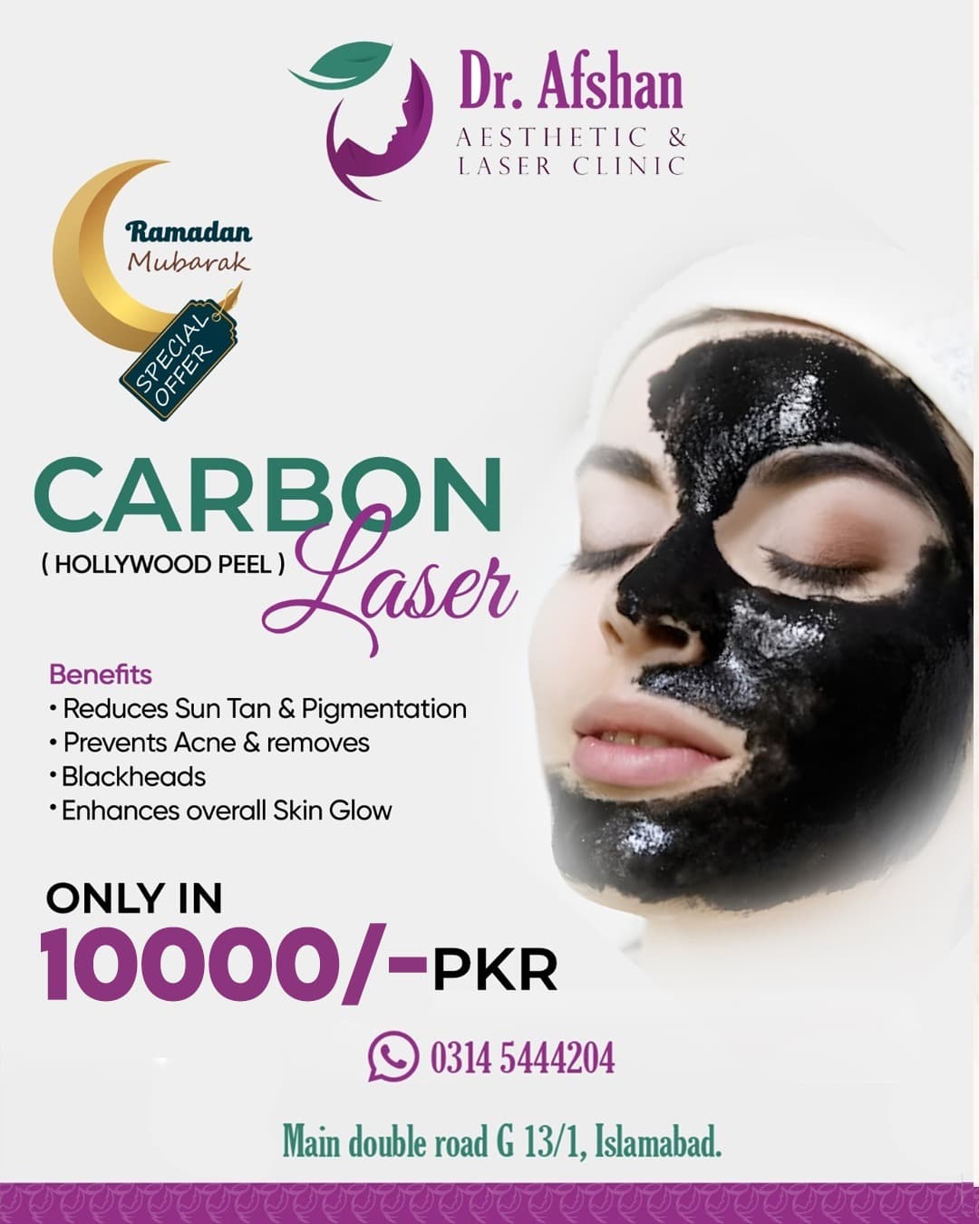 Carbon Laser (Hollywood Peel)