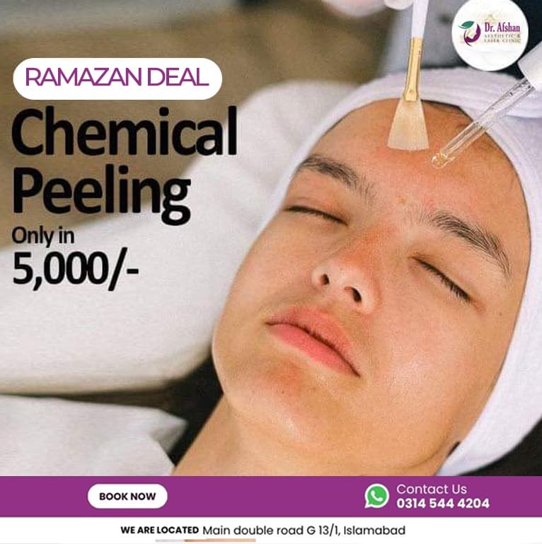Chemical Peels