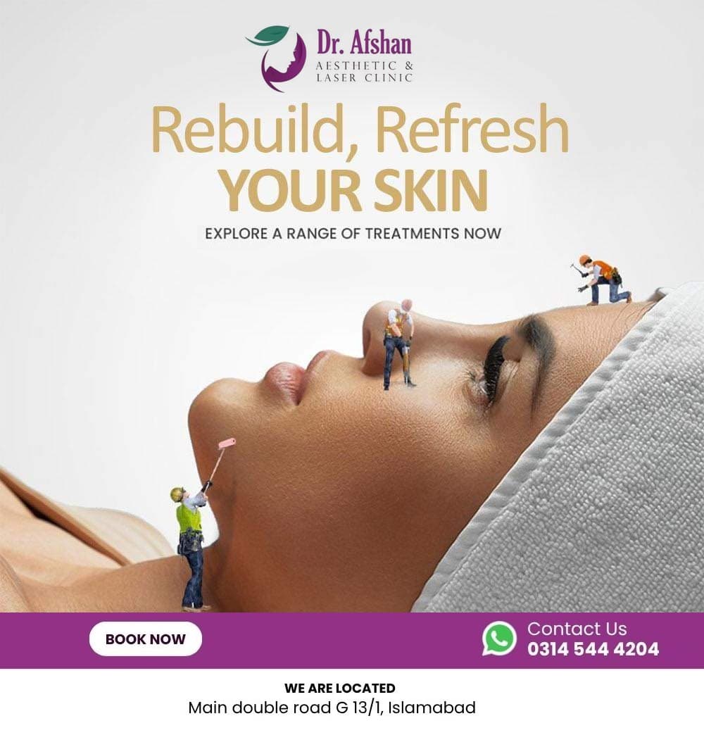Chemical Peels — result 2