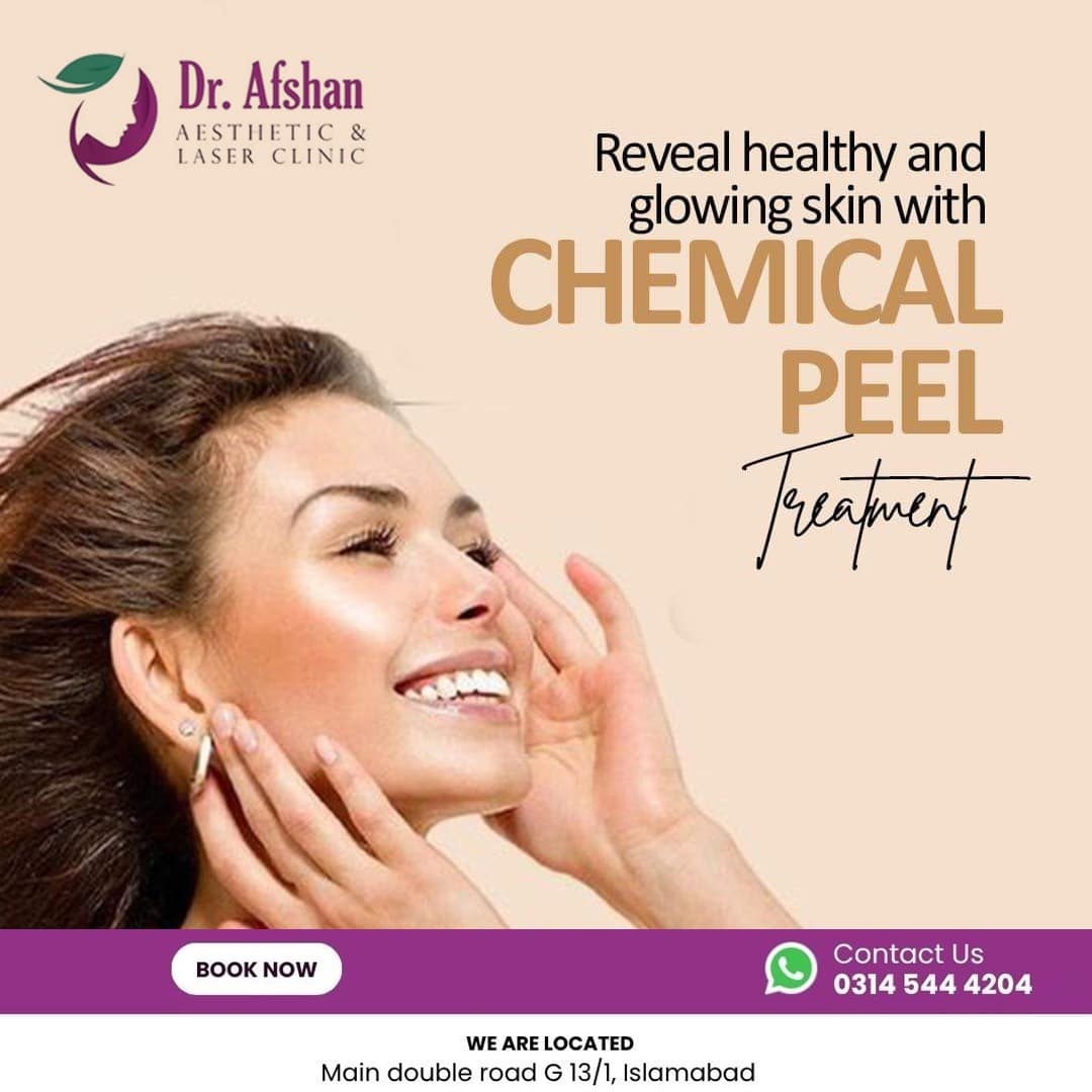 Chemical Peels — result 3