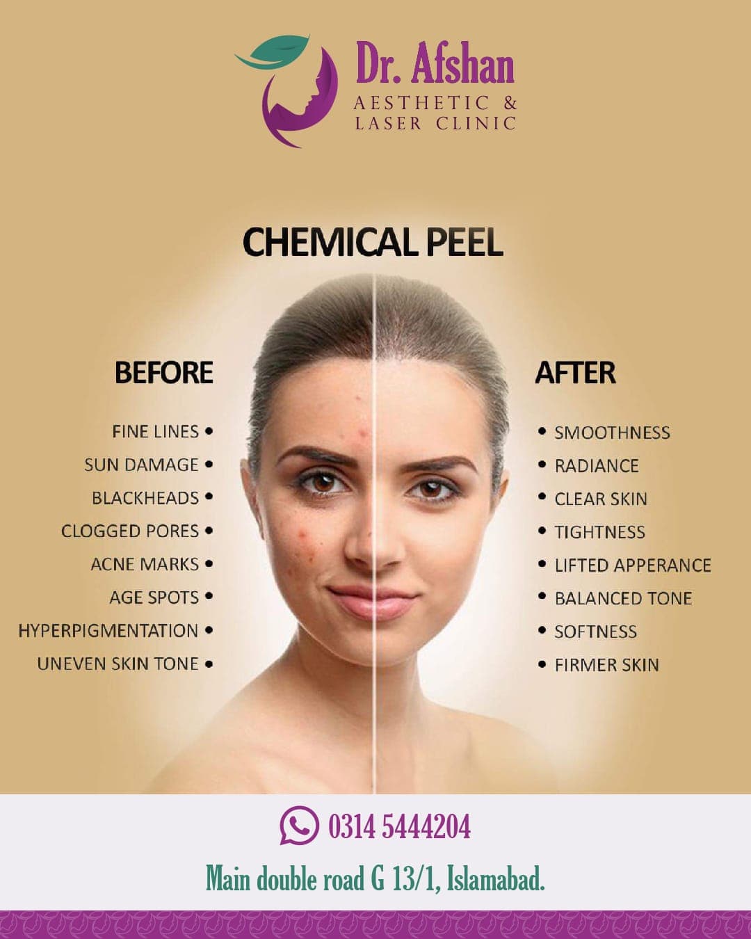 Chemical Peels — result 6