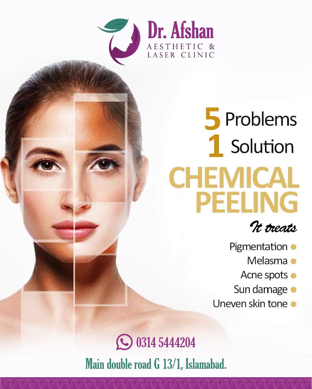 Chemical Peels — result 8