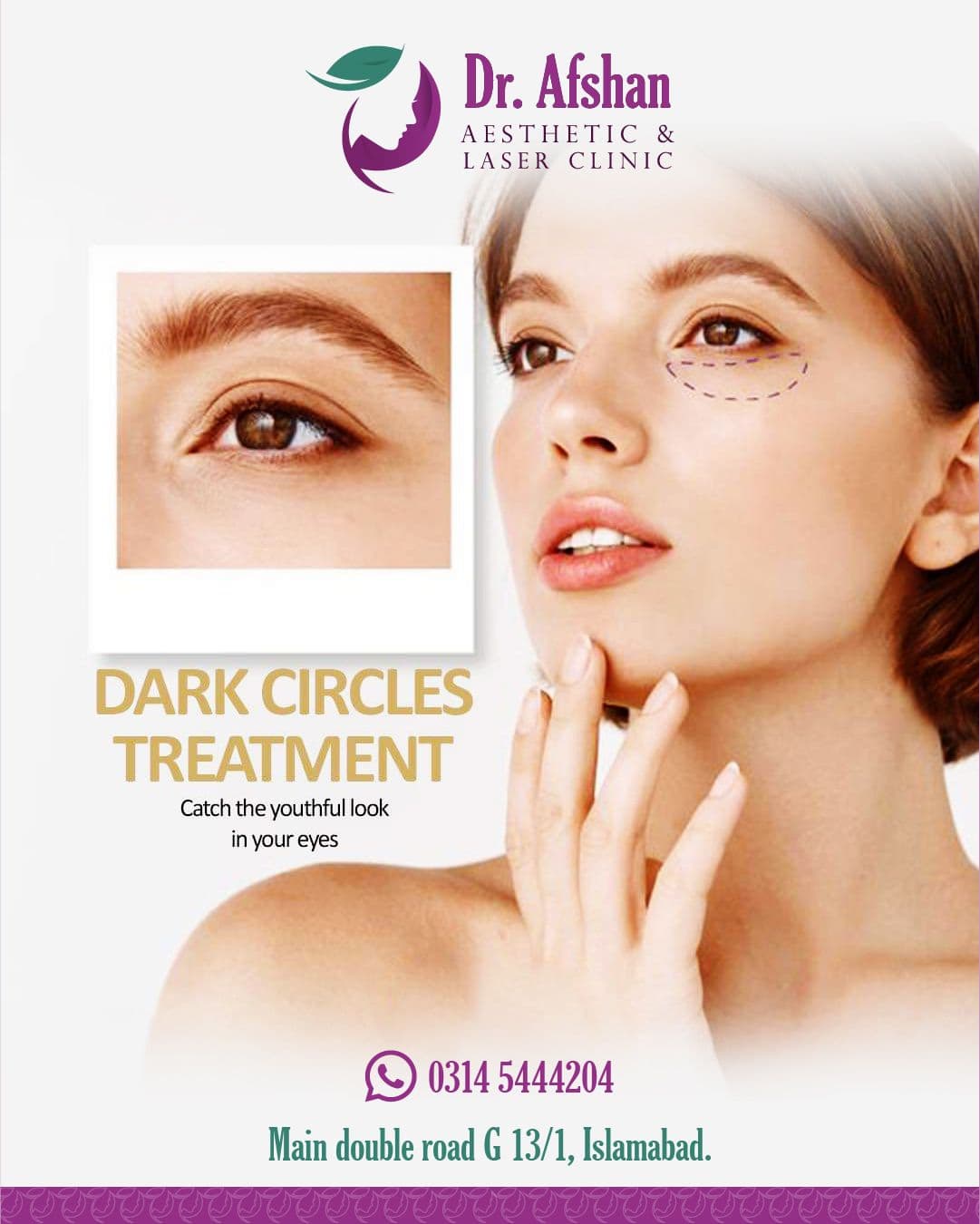 Dark Circle Treatment