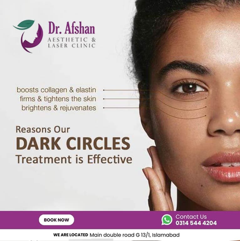 Dark Circle Treatment — result 4