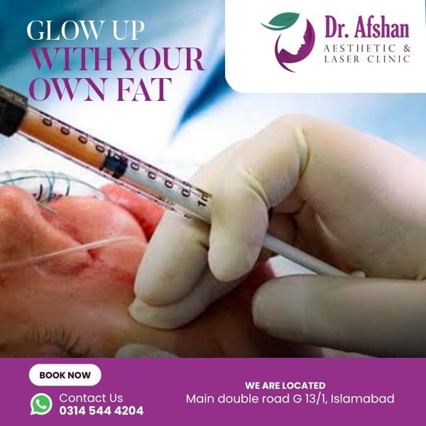 Fat Grafting — result 1