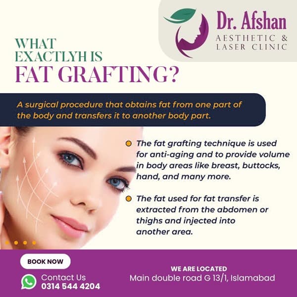 Fat Grafting — result 3
