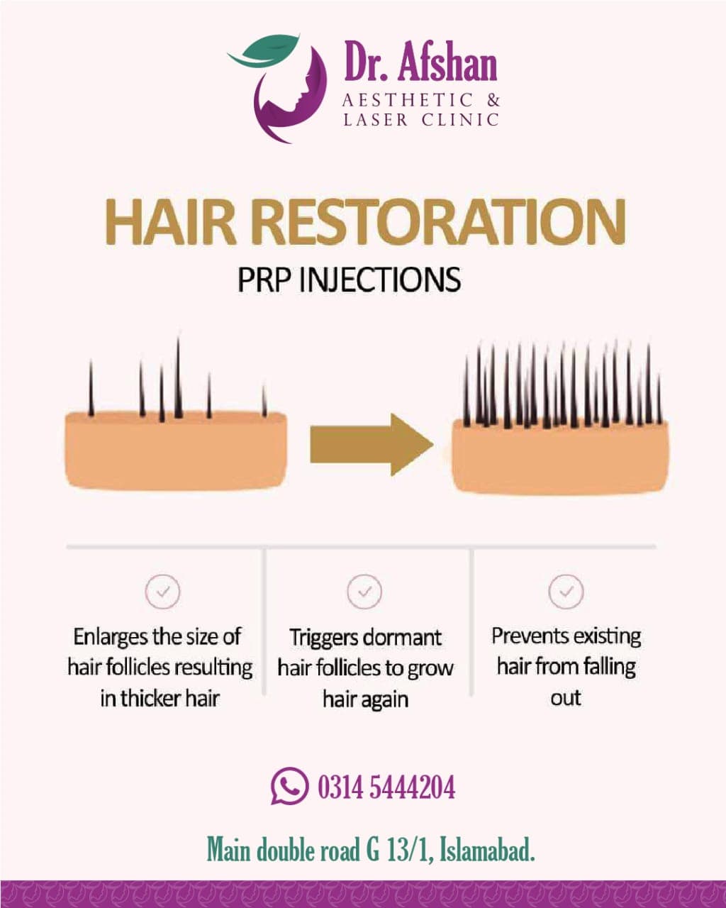 Hair Restoration — result 4
