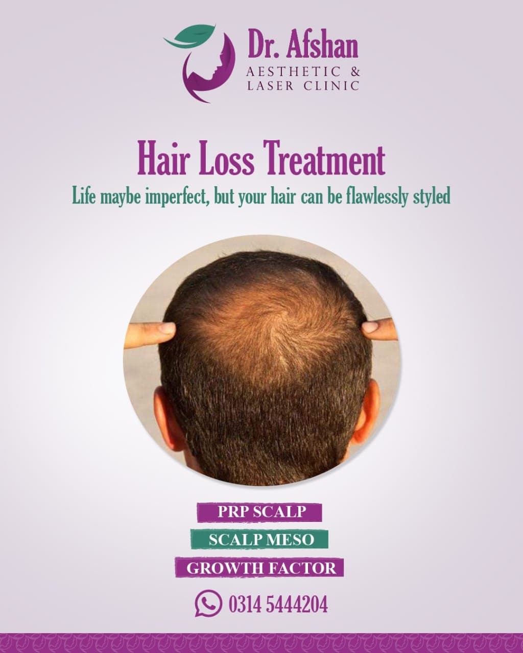 Hair Restoration — result 5