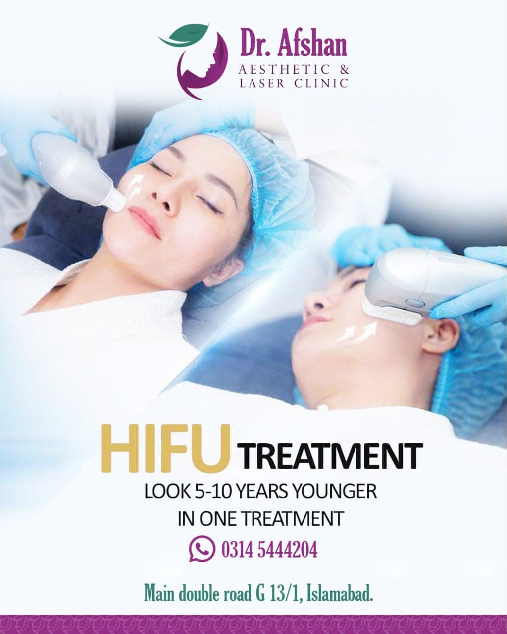 HIFU Face Lift — result 2