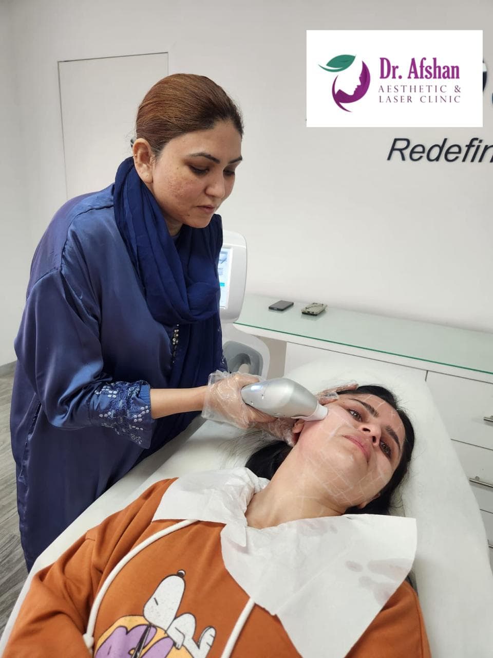HIFU Face Lift — result 5
