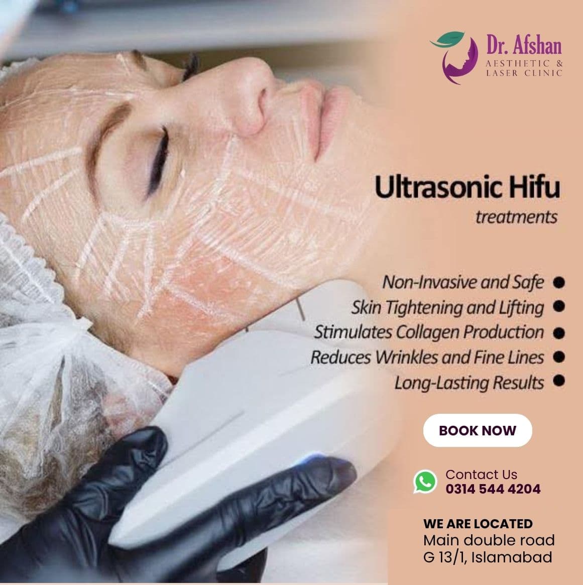 HIFU Face Lift — result 8