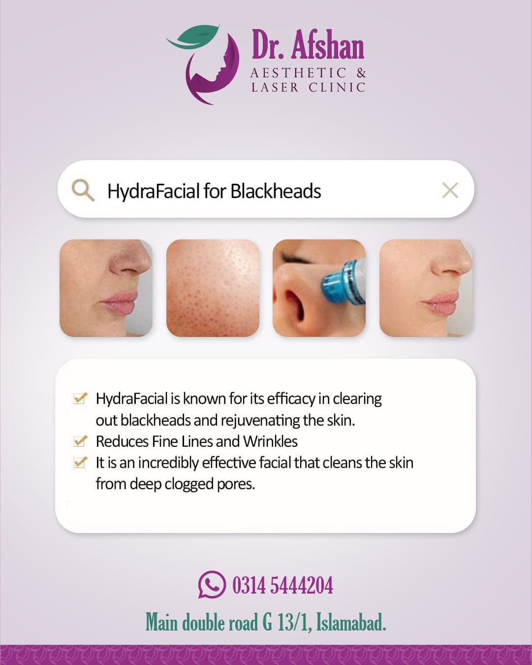 HydraFacial — result 2