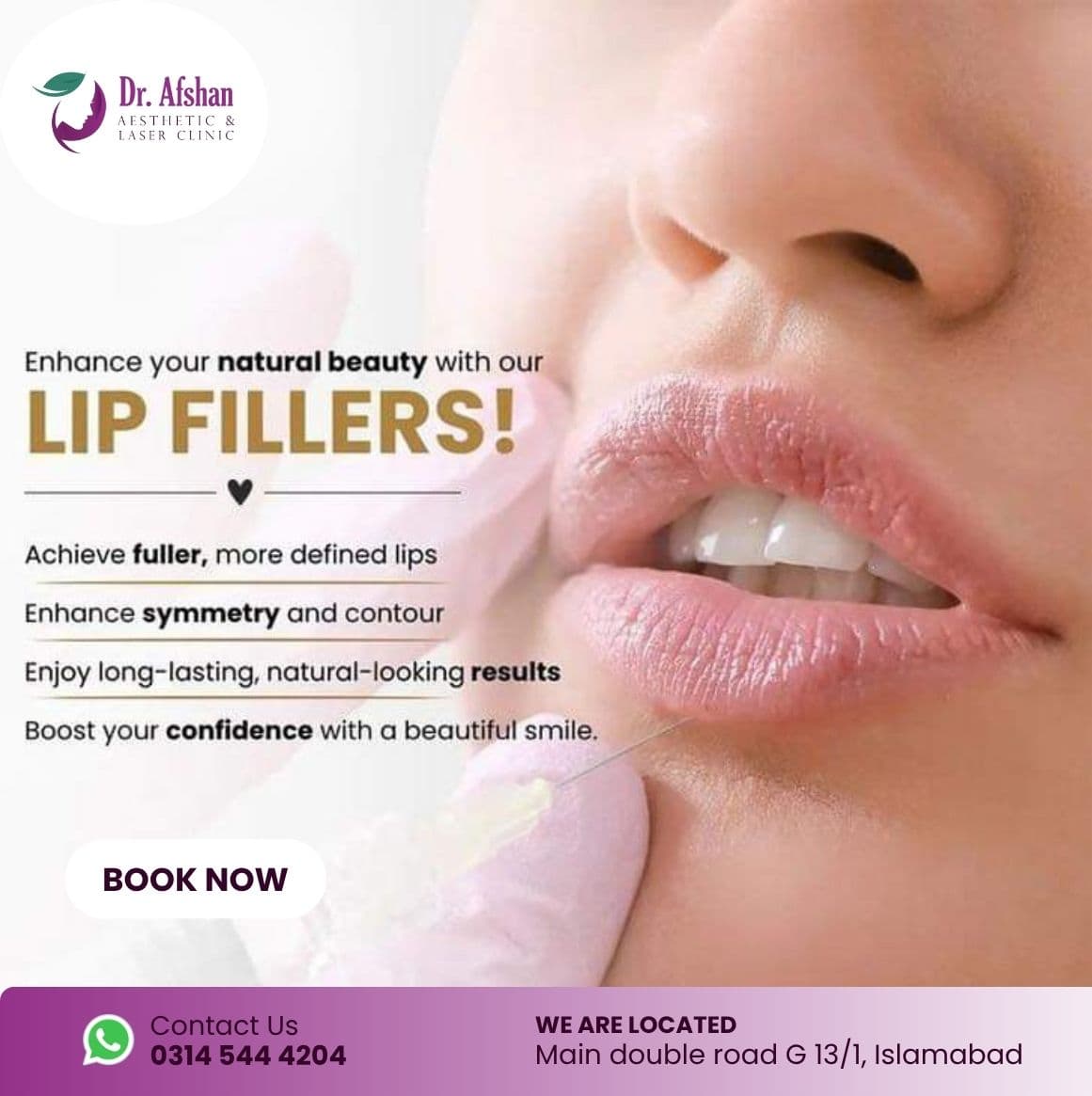 Lip Fillers