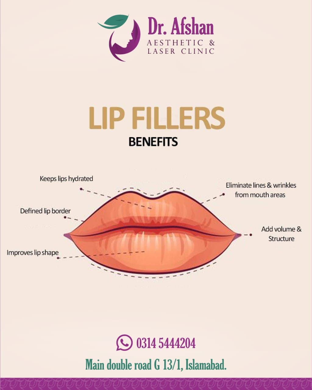 Lip Fillers — result 4