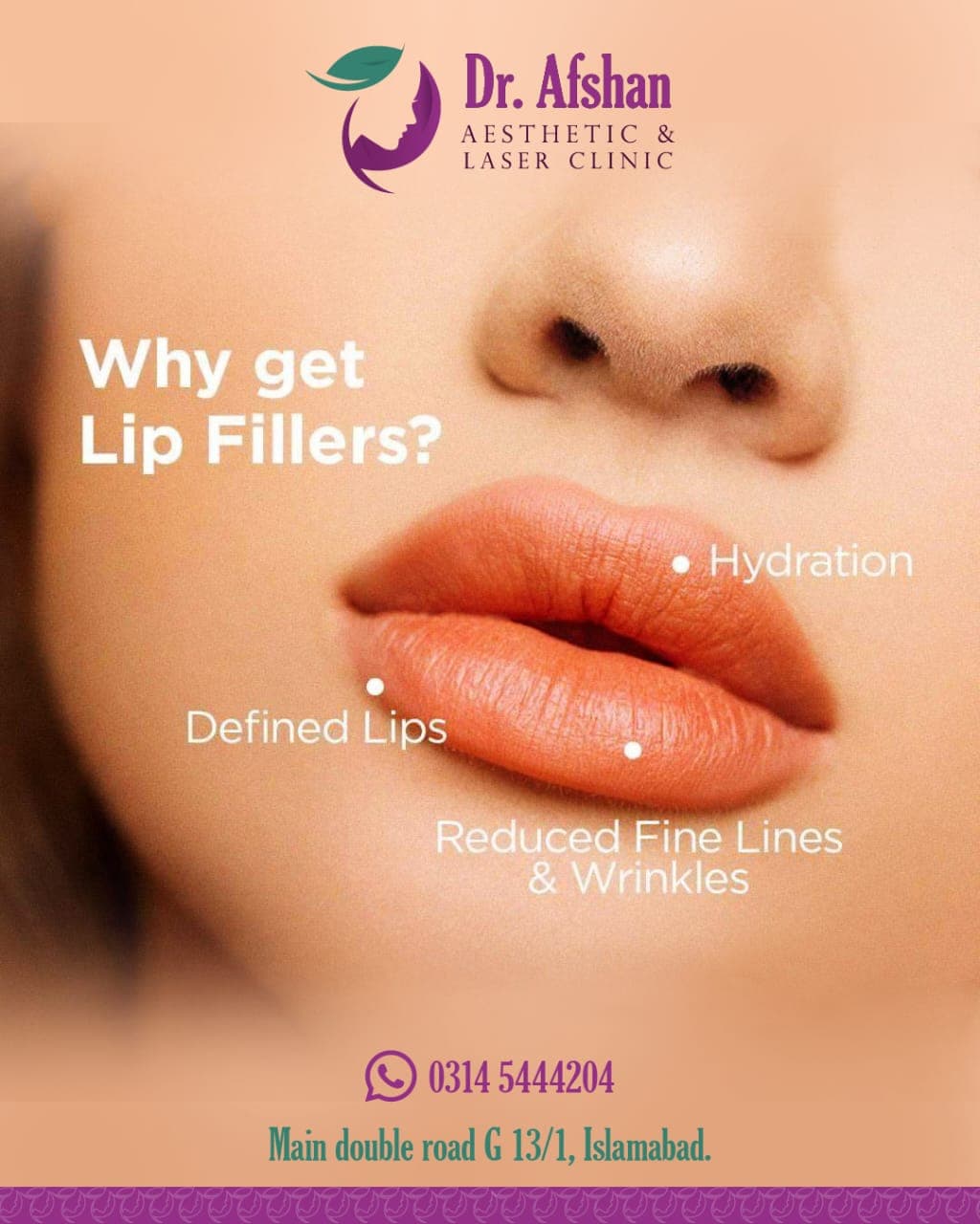 Lip Fillers — result 5