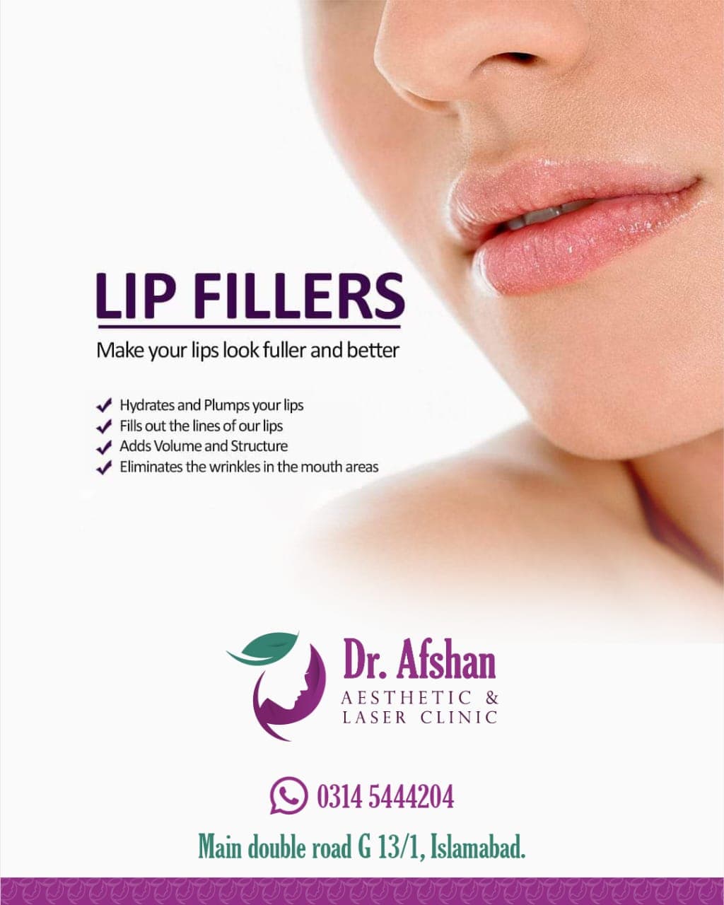 Lip Fillers — result 6