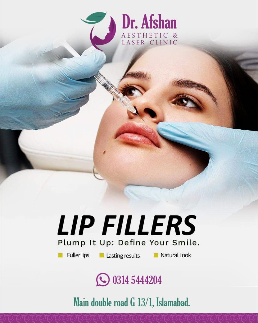 Lip Fillers — result 7