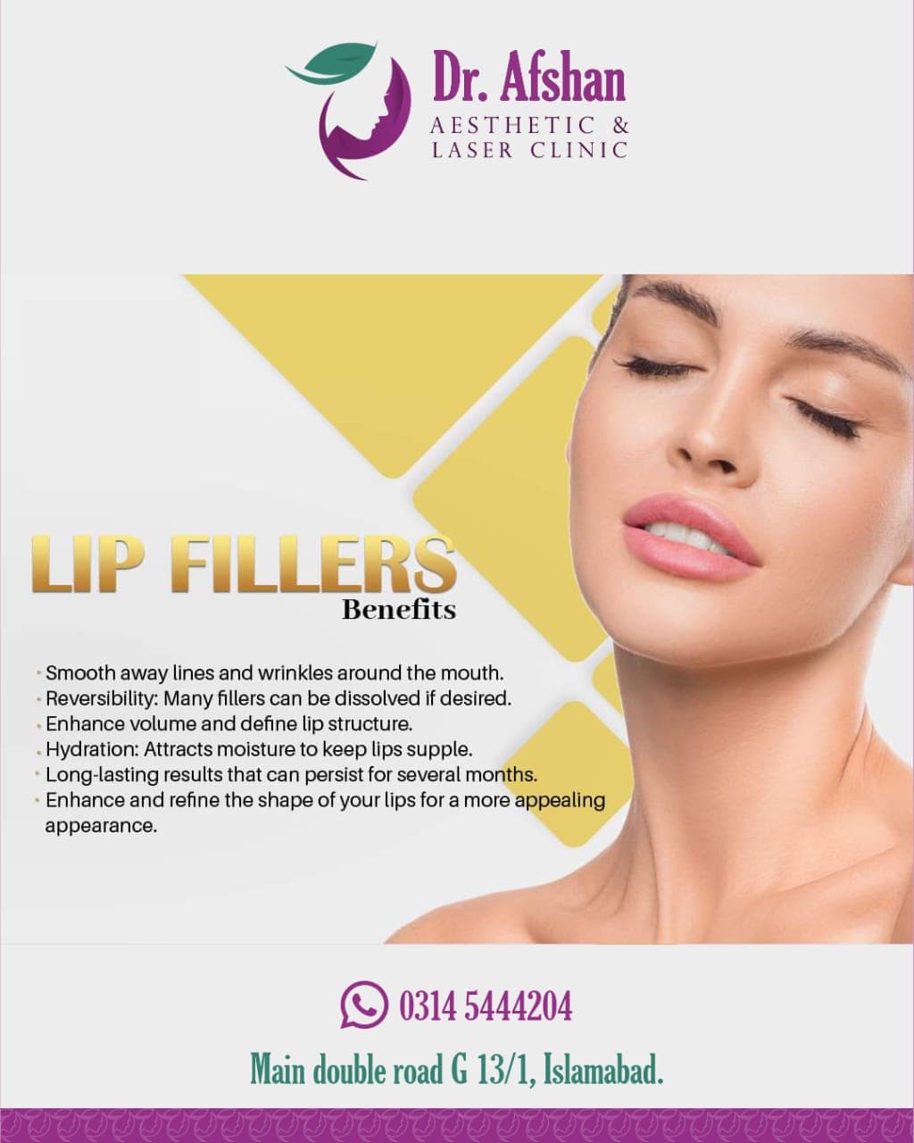 Lip Fillers — result 8