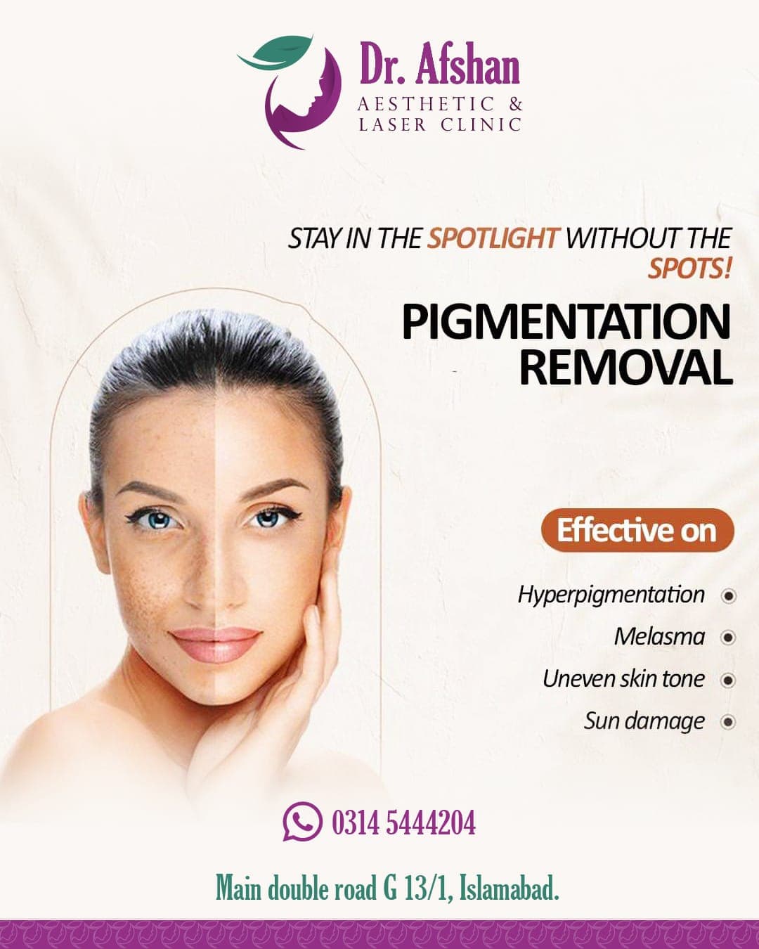 Melasma & Pigmentation — result 7