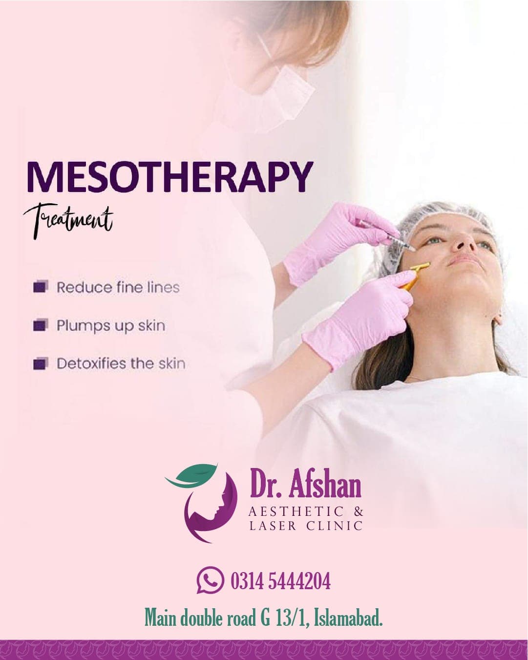 Mesotherapy — result 5
