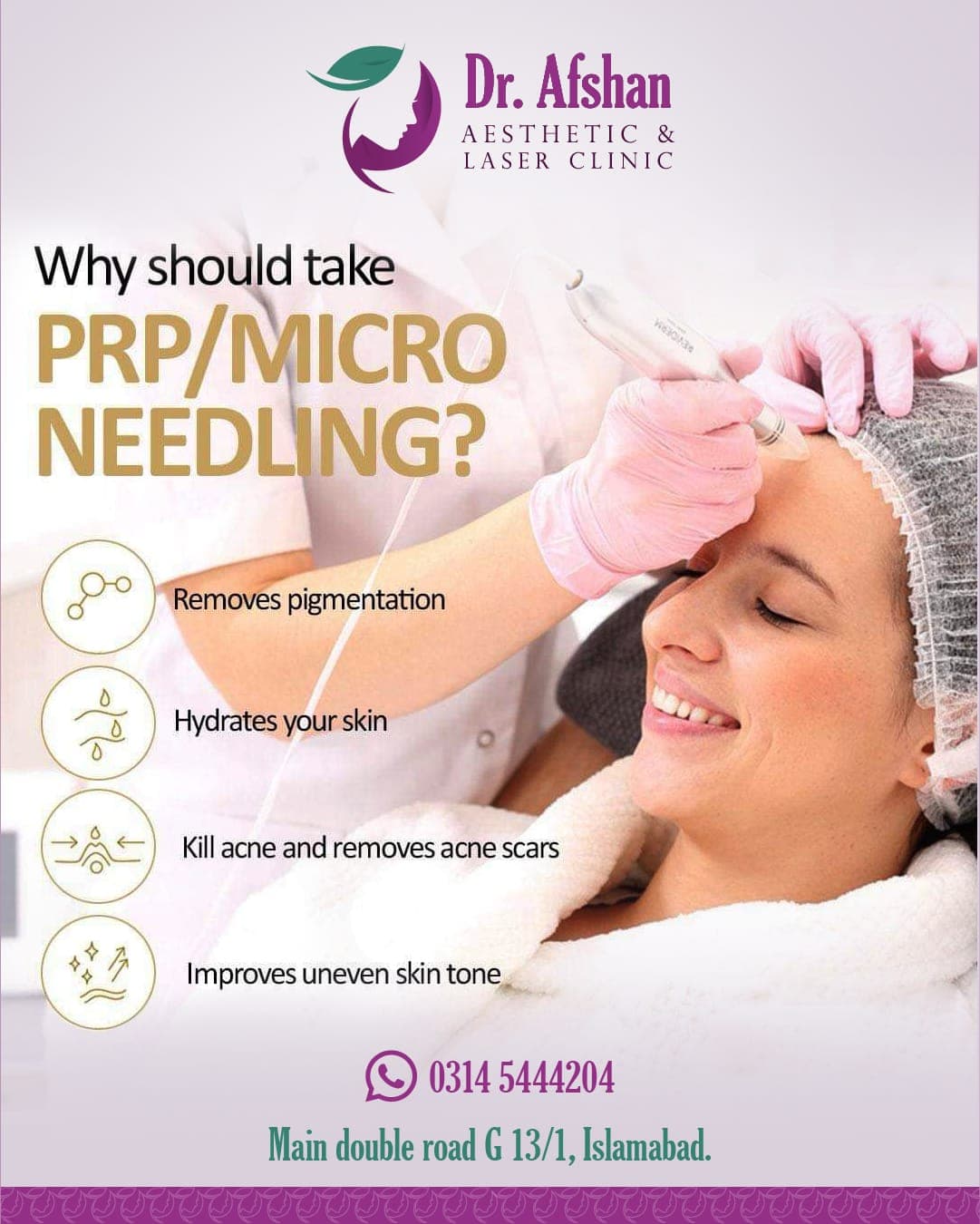 Microneedling — result 3