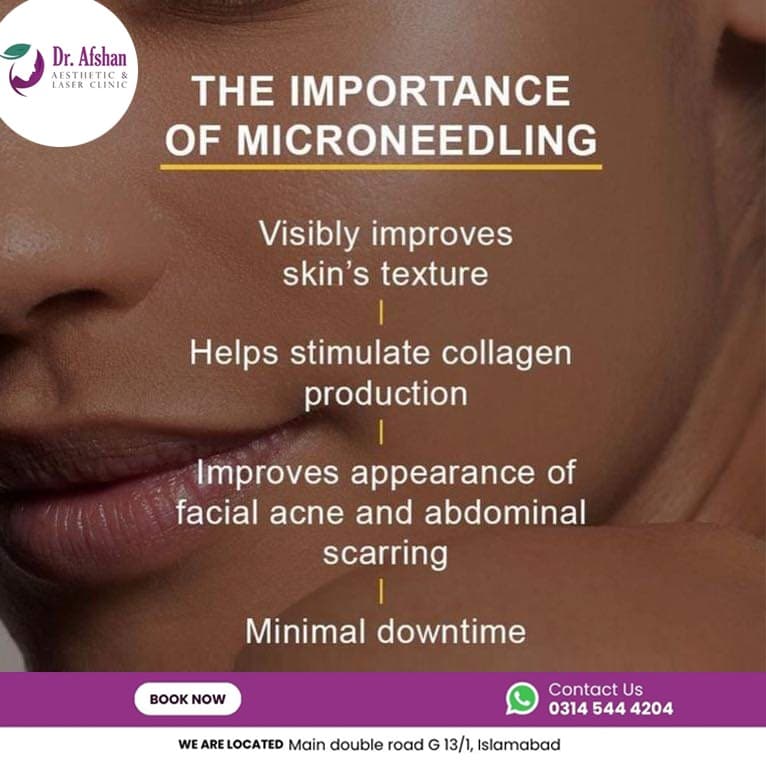 Microneedling — result 4