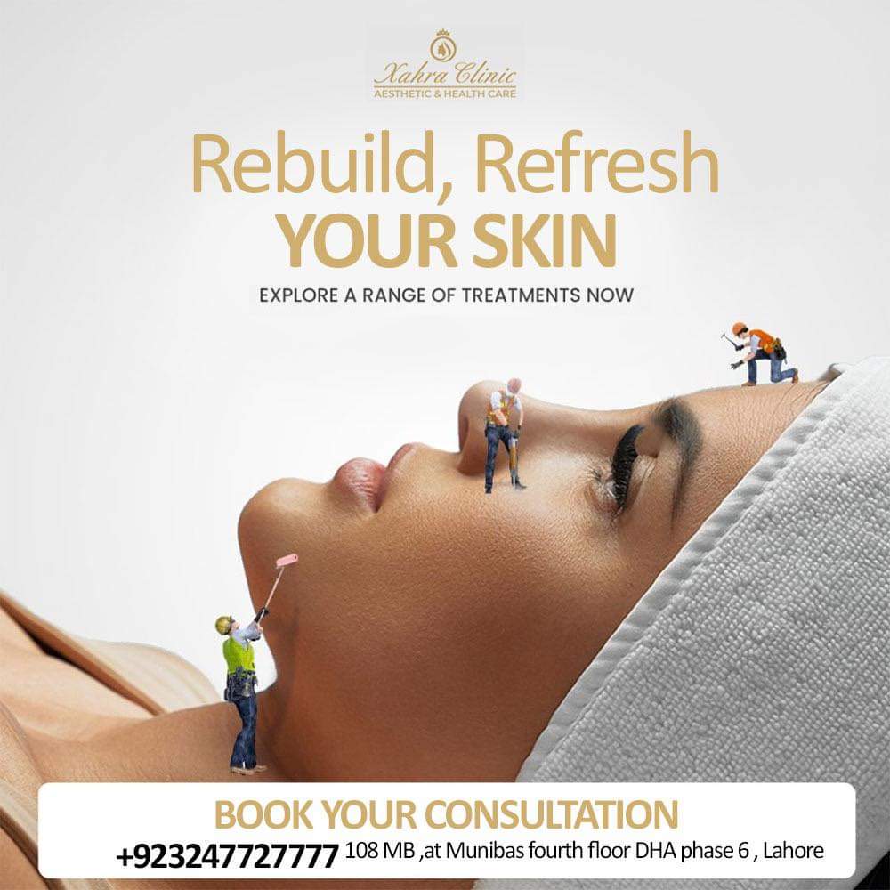 Microneedling — result 5