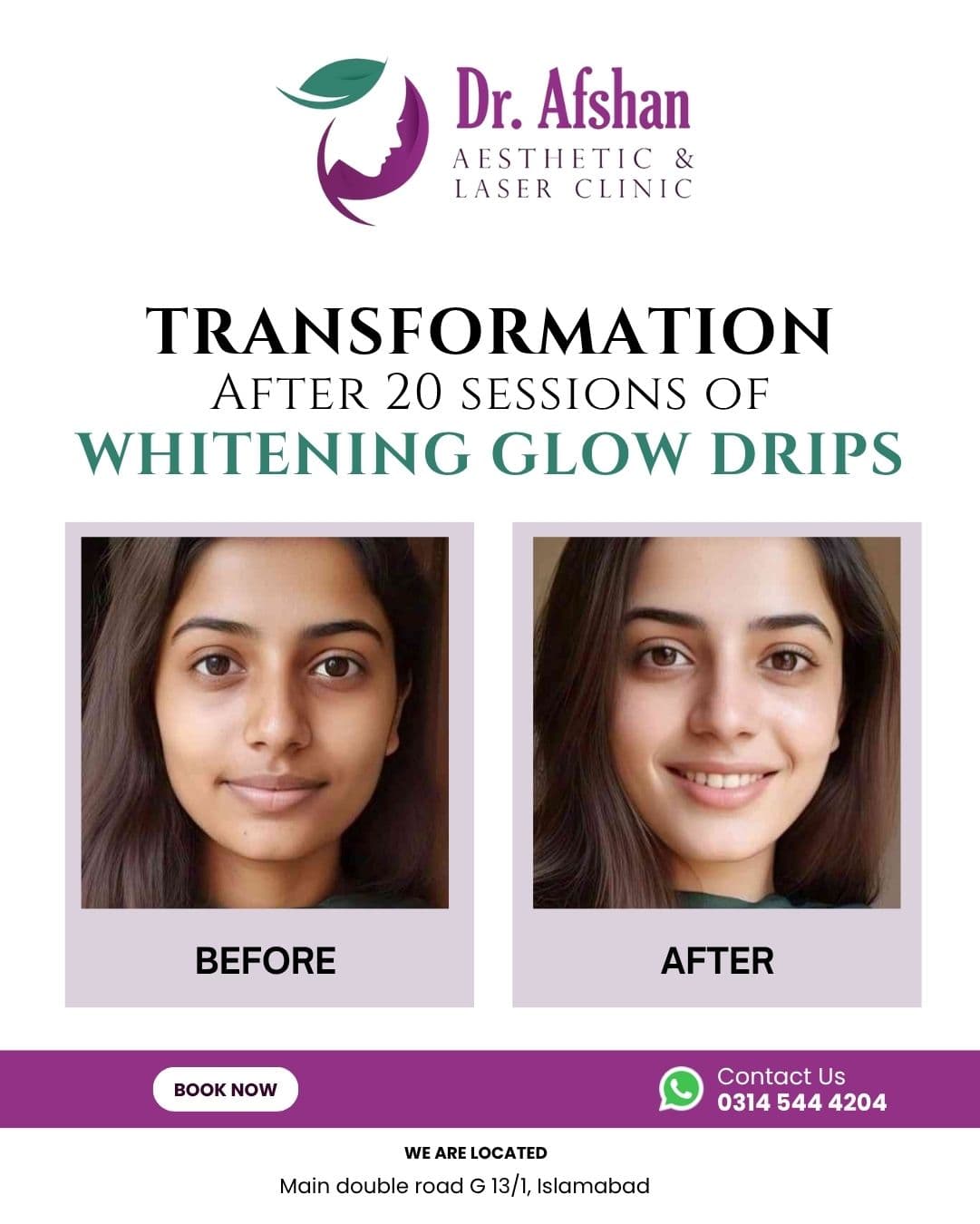 Whitening & Glow Drips — result 1