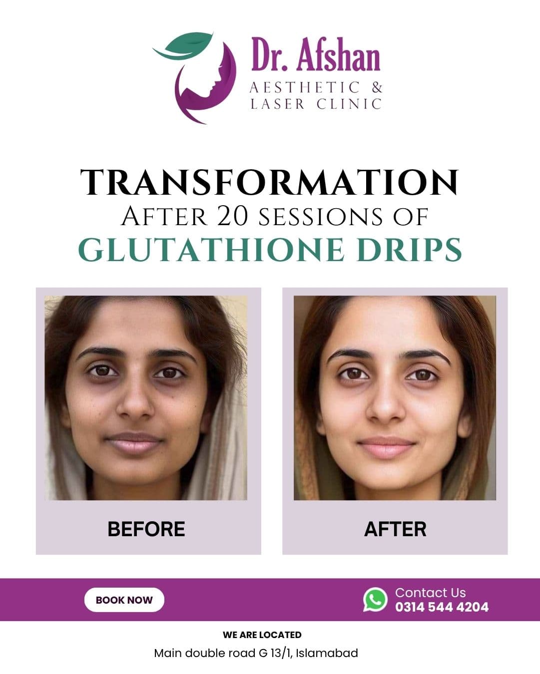Whitening & Glow Drips — result 2