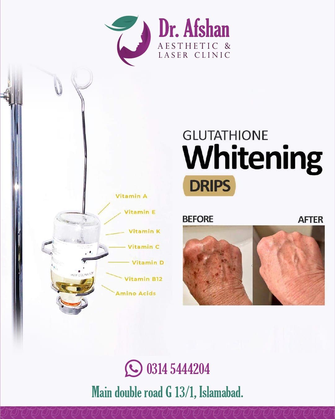 Whitening & Glow Drips — result 6