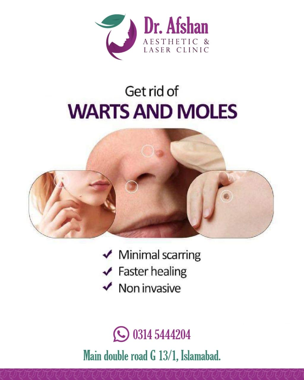 Warts & Moles Removal — result 2